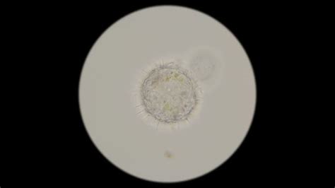  Rhizopoda! En mikroskopisk mästare som använder falska fötter för att röra sig