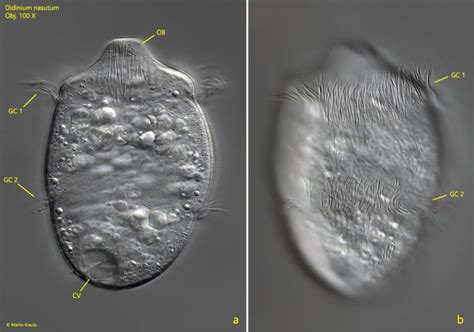  Didinium: En mystisk mikro-kung som dansar med döden!